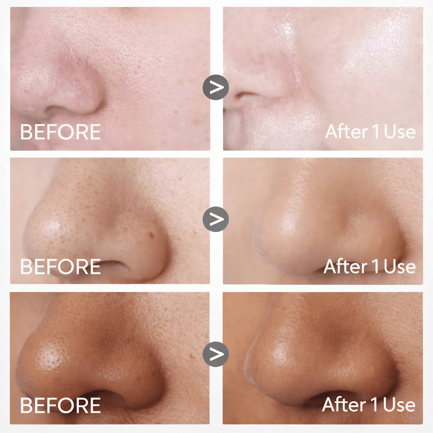 Nuvita Volcanic Clay Pore Stick