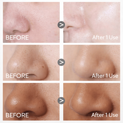 Nuvita Volcanic Clay Pore Stick